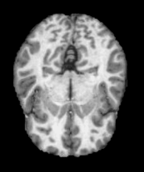 Alzheimer's Researcher